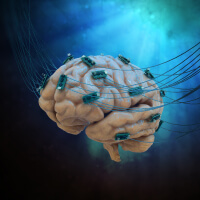 Transcranial direct current stimulation picture